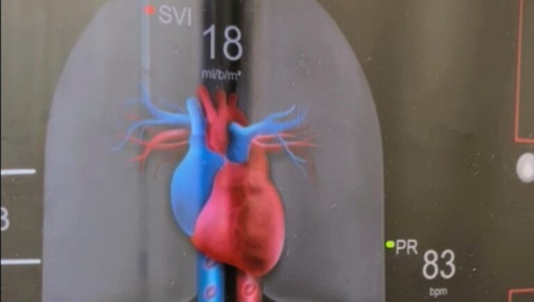 Frosinone – La Cardiologia dello Spaziani ottiene un riconoscimento internazionale